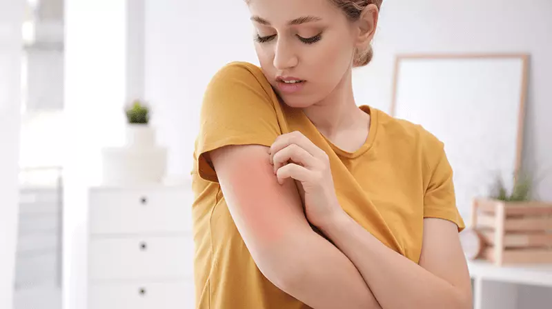 A bőrallergia fajtái, felismerése és kezelése