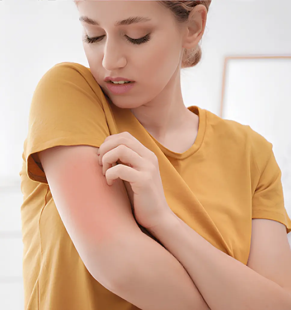 A bőrallergia fajtái, felismerése és kezelése