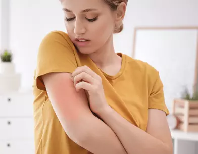 A bőrallergia fajtái, felismerése és kezelése